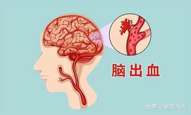 高血压的危害你注意了吗？